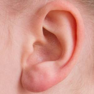 Co je tinnitus a jak ho léčit?