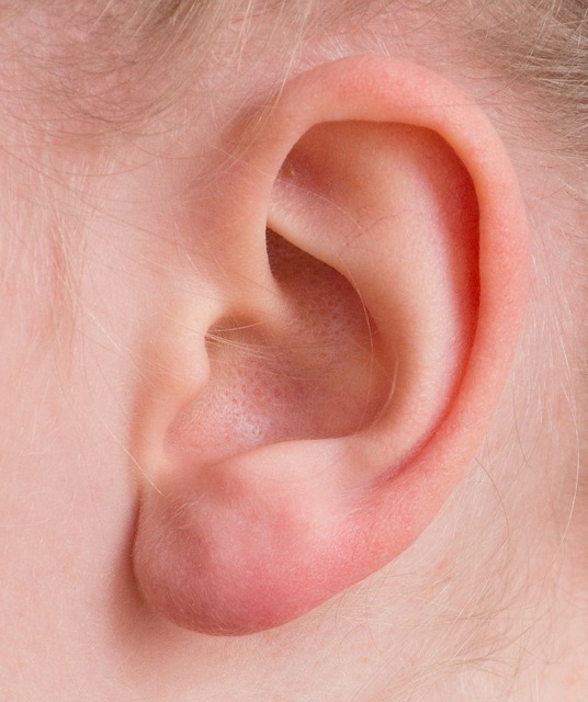 What is tinnitus and how to treat it?